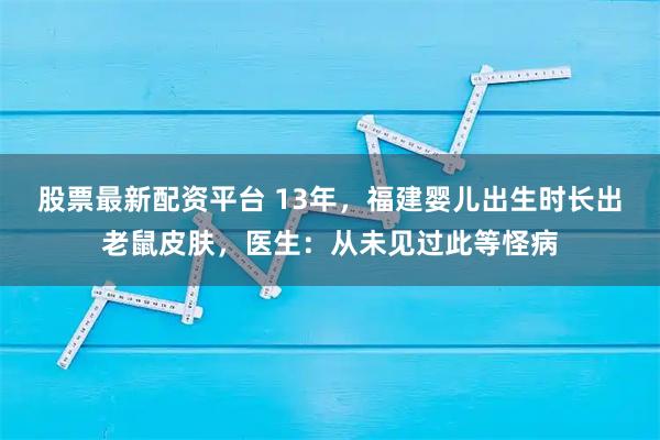 股票最新配资平台 13年，福建婴儿出生时长出老鼠皮肤，医生：从未见过此等怪病